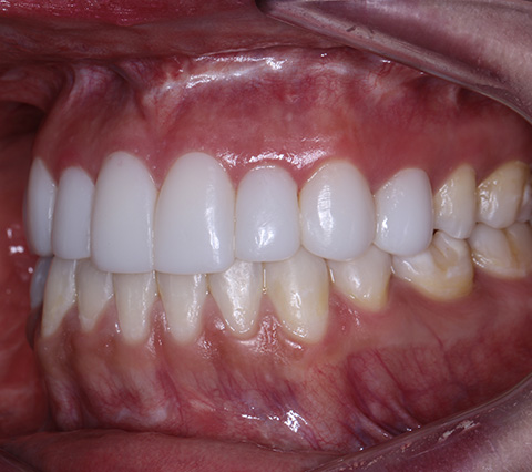 Resultado de un tratamiento maxilofacial